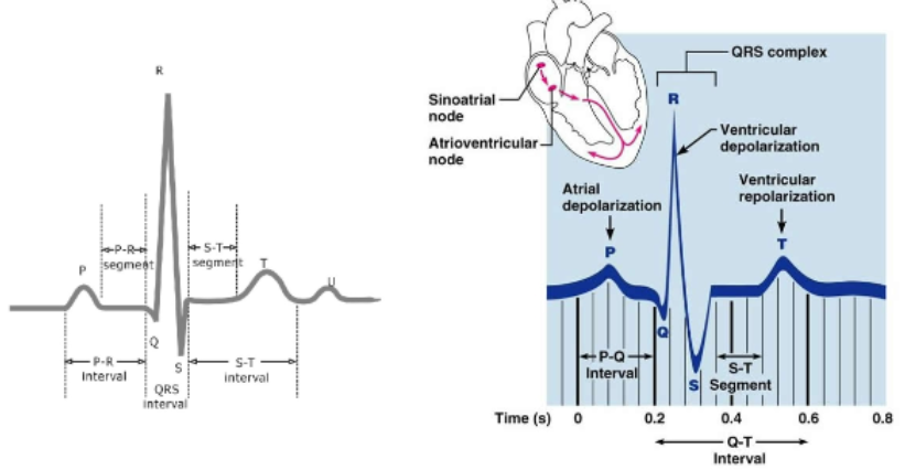 <p>depolarization of SA node → atria</p>