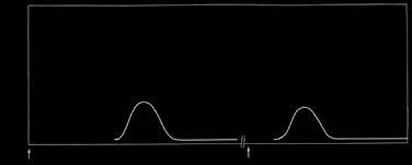 <p>When # of multivalent sites of ag &amp; ab are approximately equal. Results in optimal precipitation.</p>