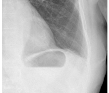 <p>What is this and what type of scan </p>