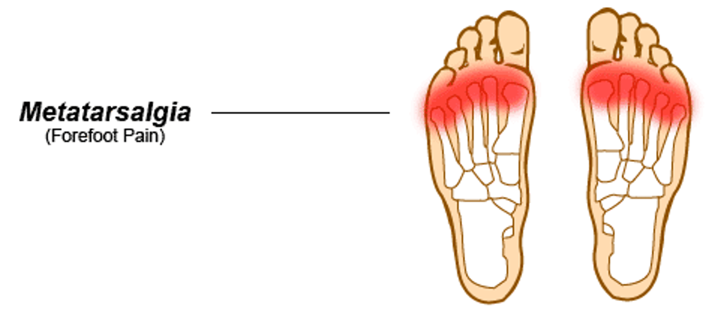 <p>soreness of middle metatarsals</p><p>abnormal mechanical stress, arthritis</p><p>plantar foot pain and fatigue with WB</p><p>callus over mid metatarsals</p><p>hypermobile or pronated foot</p><p>antalgic gait, prontated</p><p>special test: metatarsalgia</p>