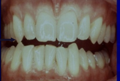 <p>What is happening</p>