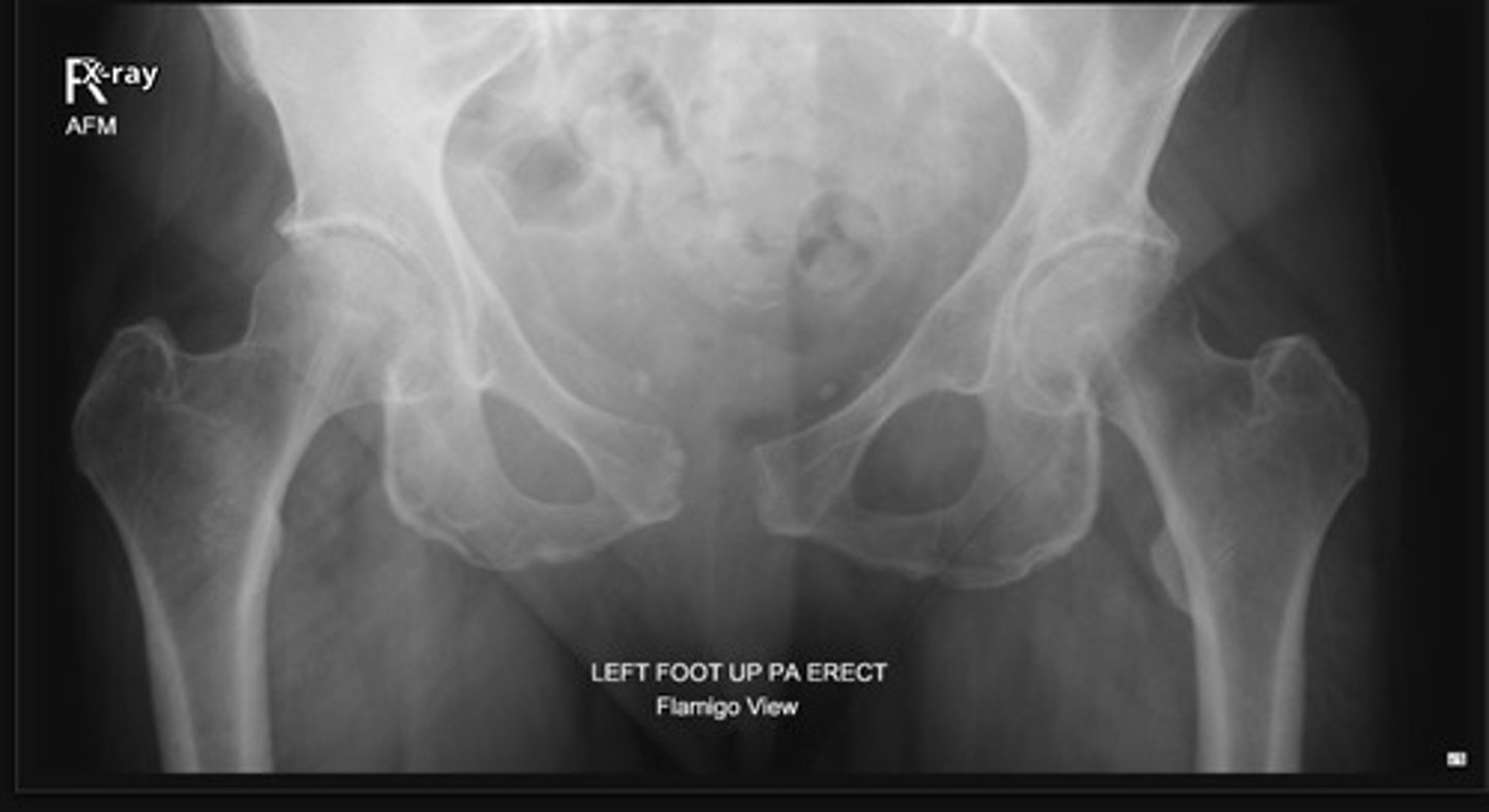 <p>Other Pelvic Views: <strong>______________</strong></p><p></p><p>o Look for instability of the pelvic ring</p>