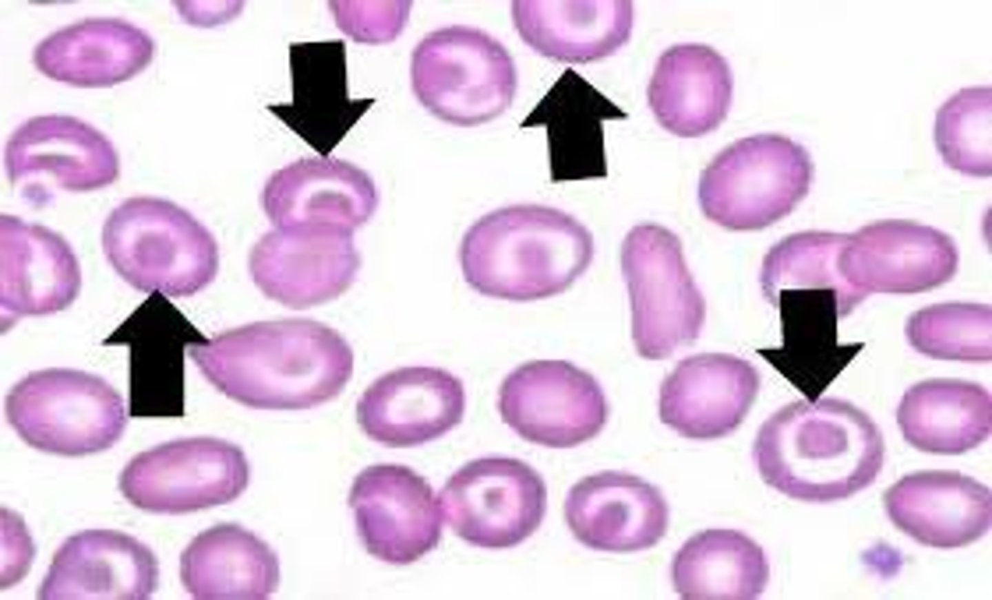 <p>Characterized by increased membrane surface area relative to cell volume- cells may take a variety of shapes.</p>