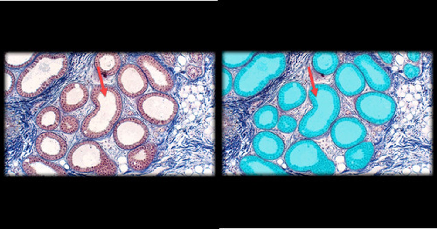 <p>- Larger and located deeper in the dermis or hypodermis. - - - - Appear as larger coiled glands with a wider lumen than merocrine glands.</p><p>- Found in specific areas like the axilla (armpits), groin, and around the nipples.</p><p>- Produce thicker, lipid-rich sweat and are associated with hair follicles, becoming active during puberty.</p>