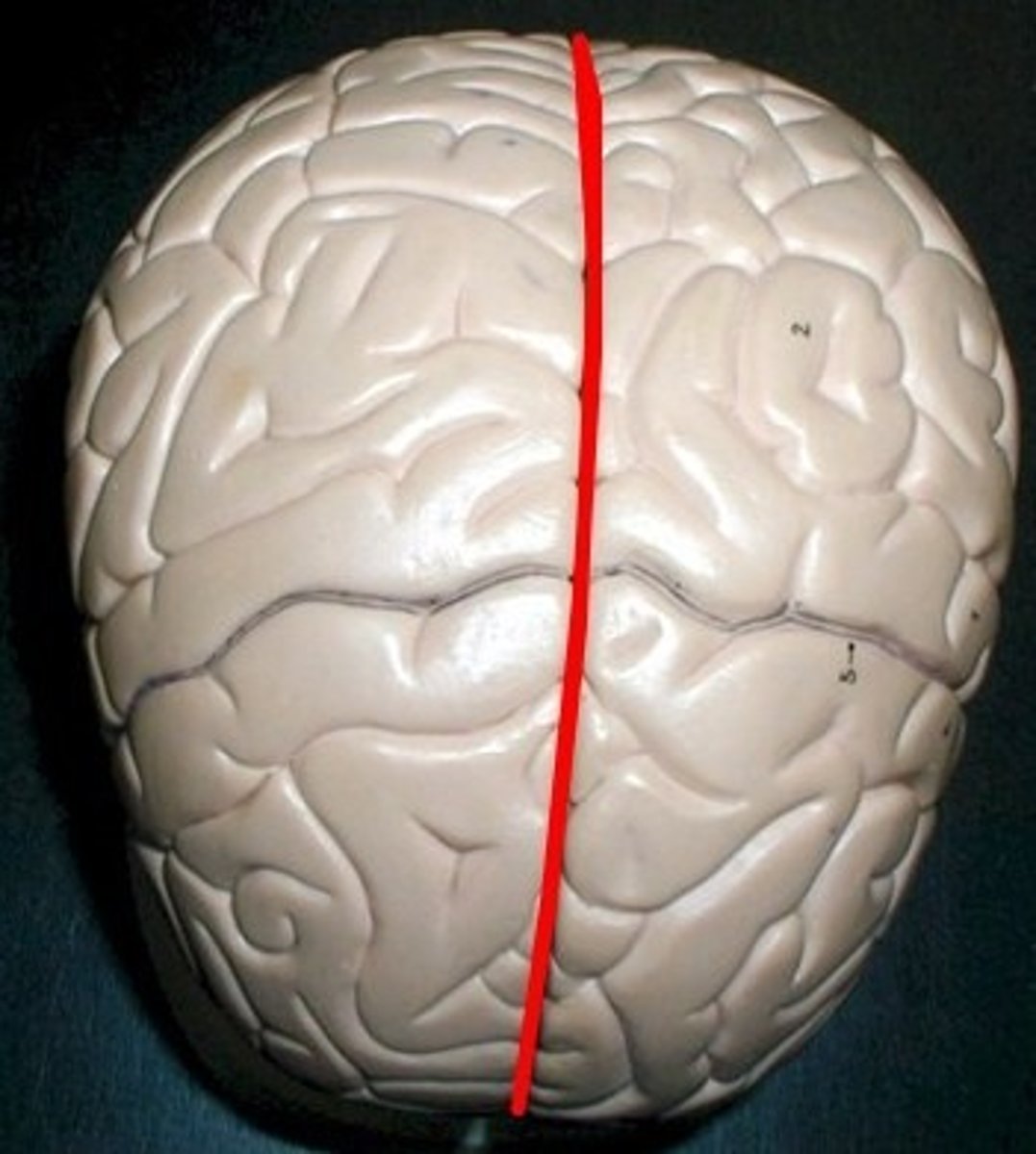 <p>deep groves in the brain like the one that divides the cerebrum into the right and left hemisphere</p>