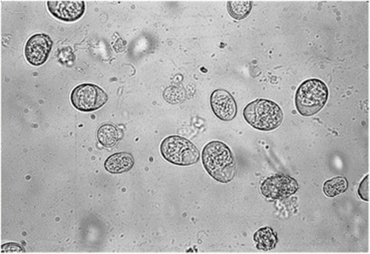 <p>While called a coccidian, this genus and species infects cattle. The protozoan is:</p>