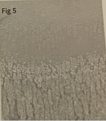 <p>The figure 5 represents:</p><p>A. Epiphyseal line</p><p>B. Direct ossification</p><p>C. Endochondral ossification</p><p>D. Spongy bone</p>