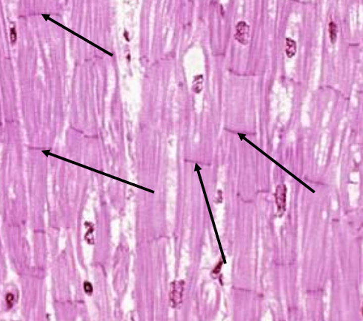 <p>What are the black arrows pointing to?</p>