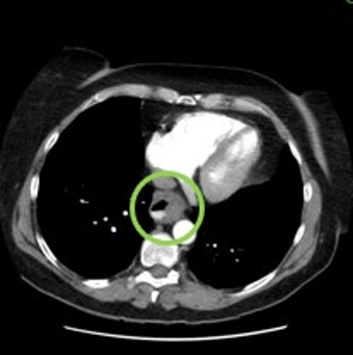 <p>Label pathology in image below</p>