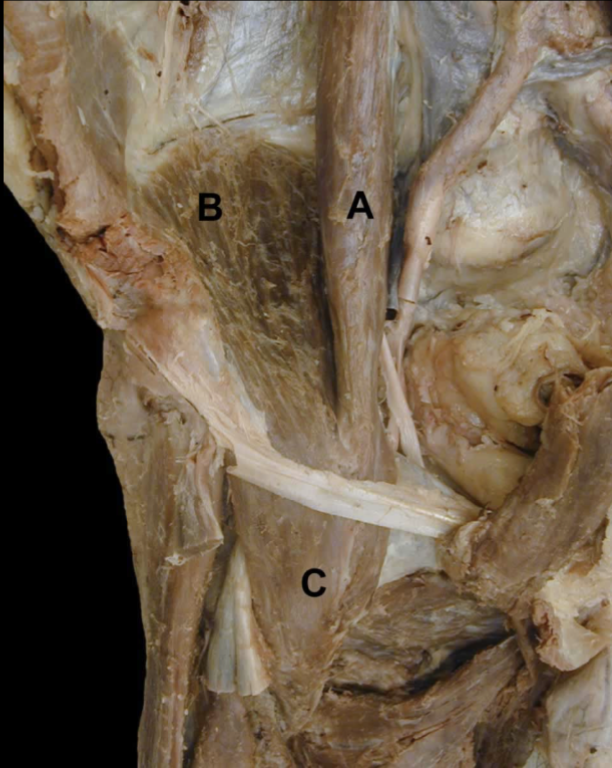 <p>Name 2 muscles that share an action with&nbsp;“C”</p>