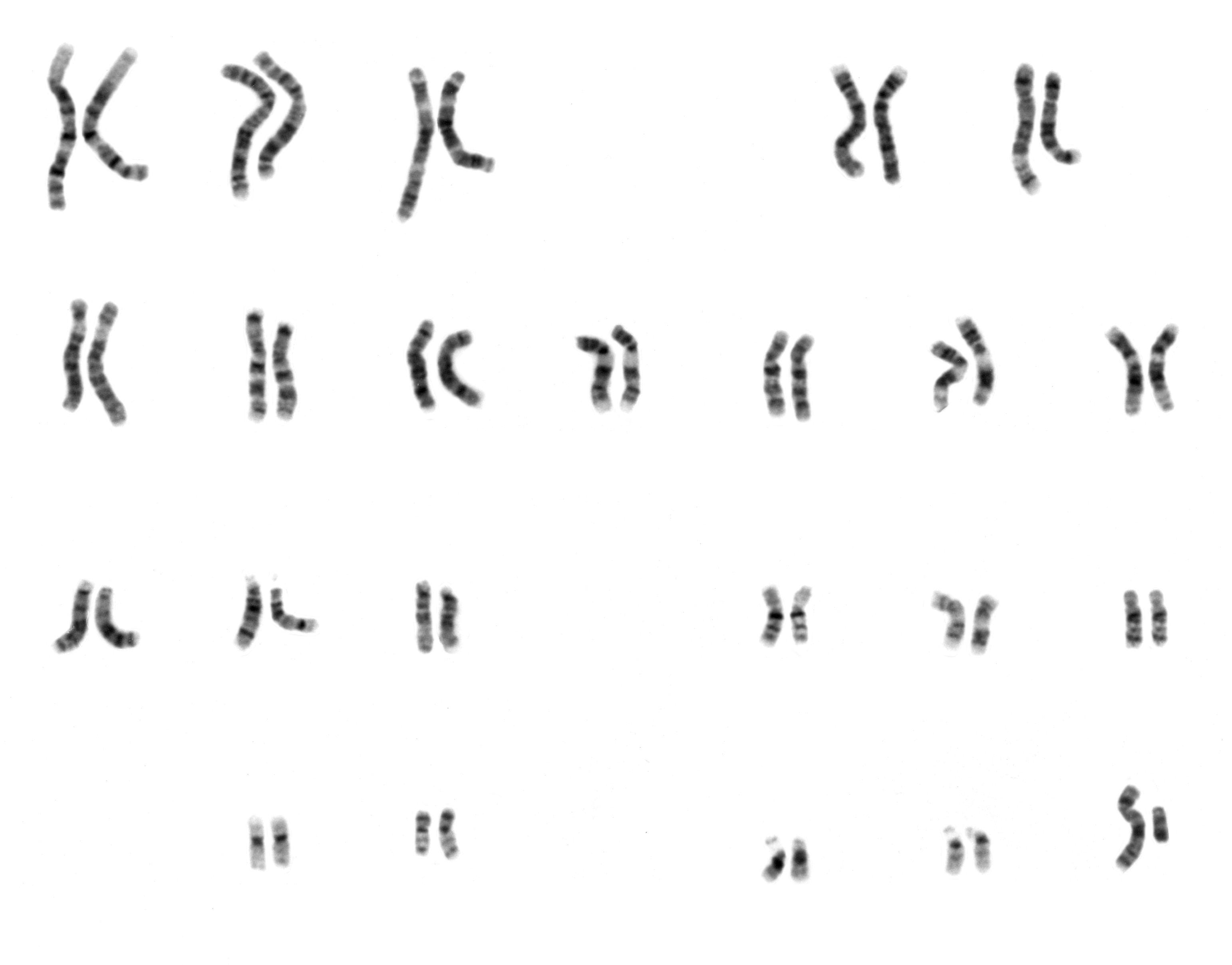 A profile of an individual's chromosomes, showing the number and structure of chromosomes.