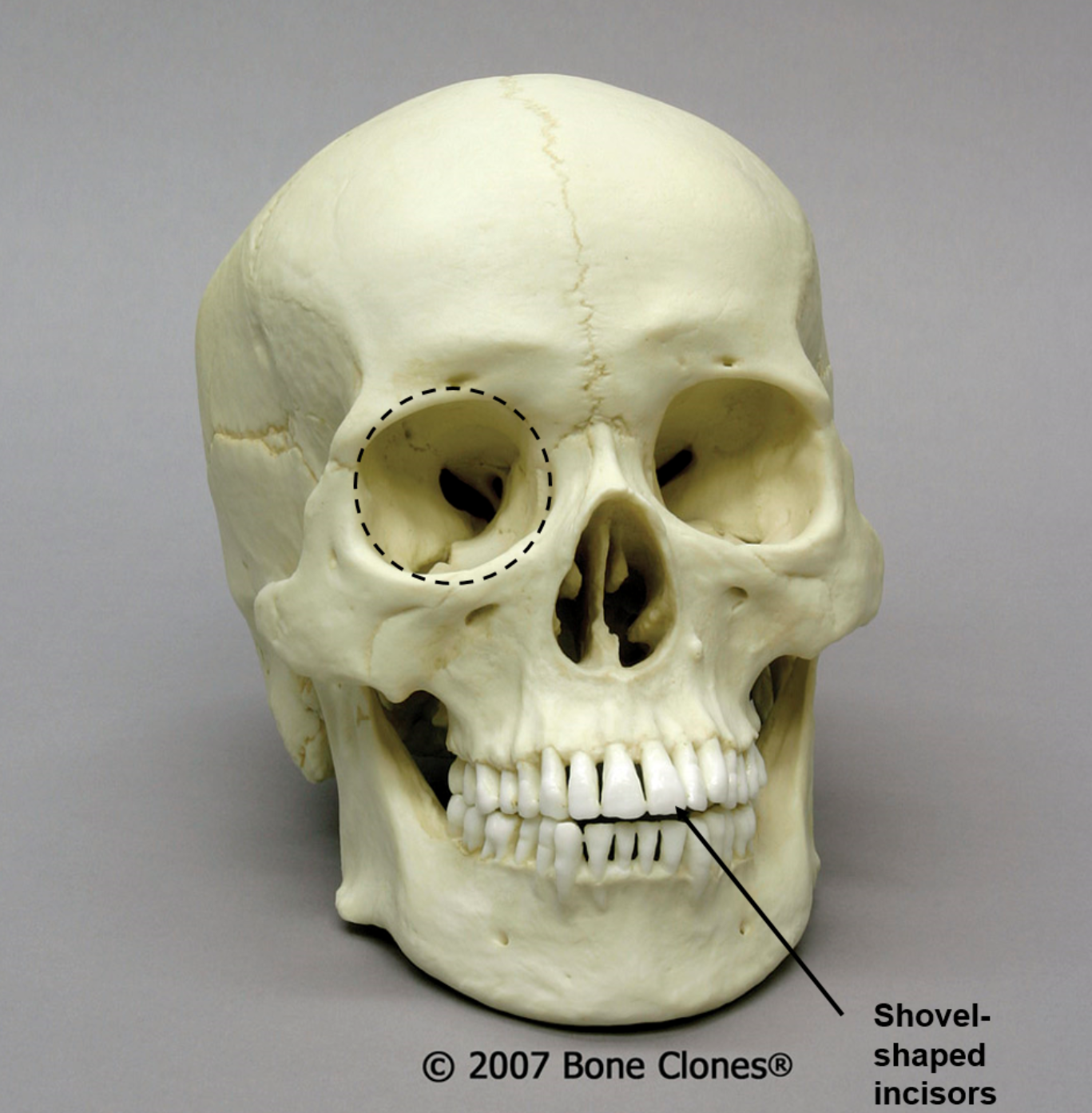 <p><span>What is the ancestry of this skull?</span></p>