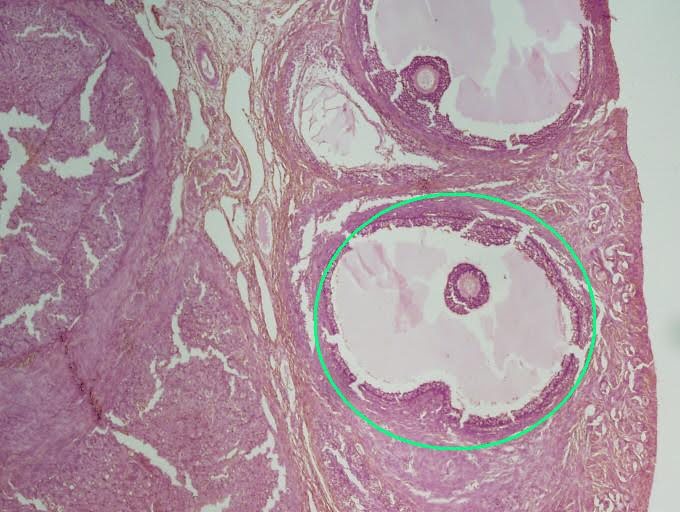 <p><span><span>Name a hormone producing cells are found in the indicated region within the ovary?</span></span></p>