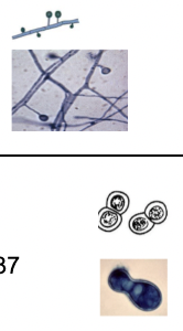 <p>Mould - septate hyphae with conidia</p><p>Yeast - broad based budding cells </p>