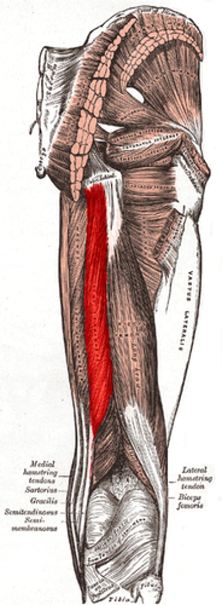 <p>picture</p>
