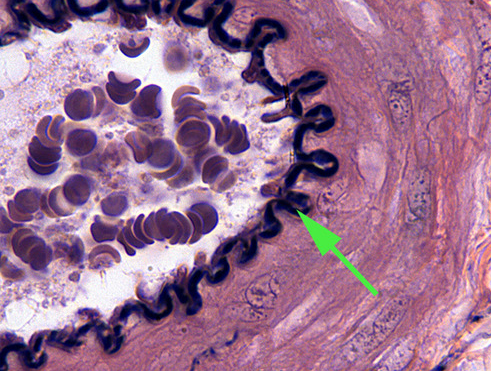 <p><span>The black twisted line is elastic tissue found in elastic arteries. The squiggly line is called the <strong>internal elastic</strong> membrane.</span></p>