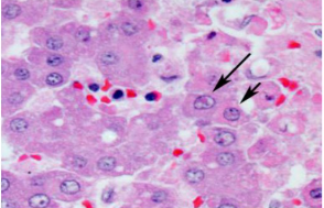 <p>Adults can have ocular/vaginal discharge</p><p>Viraemia due to macrophage infection</p><p>Puppies:</p><ul><li><p>anorexia</p></li><li><p>hypothermia</p></li><li><p>vocal</p></li><li><p>disorientated</p></li><li><p>fading puppy syndrome?</p></li></ul><p>Bilateral, multifocal, petechial and ecchymotic haemorrhage of kidneys and liver</p><p>Necrosis of kidneys, liver and lungs on histo, along with intranuclear viral inclusion bodies</p>