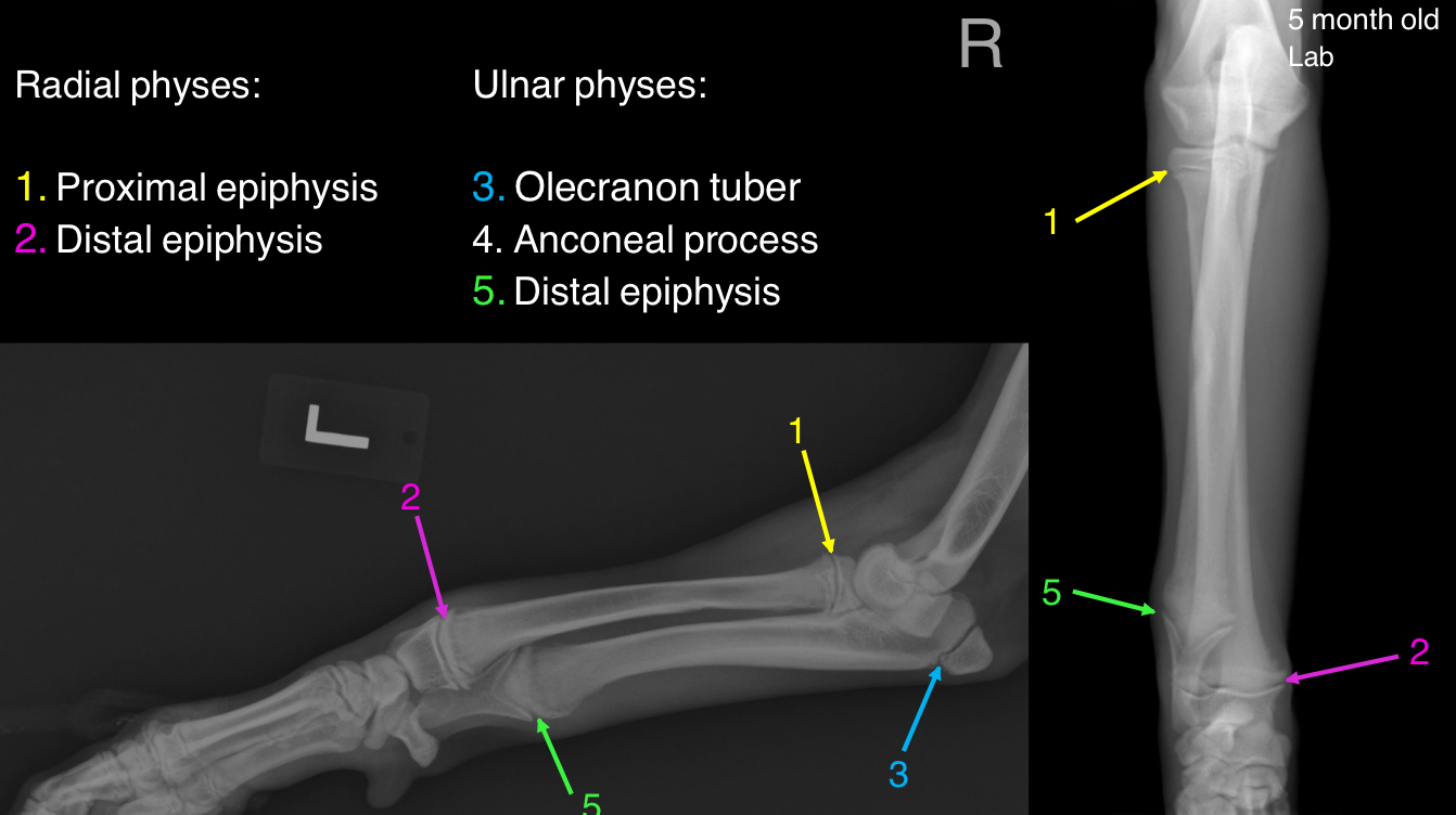 <ul><li><p>proximal</p></li><li><p>Distal</p></li></ul>