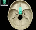 <p><span>Cube-shaped part with central concavity (sella turcica) for pituitary gland<br>Articulates with ethmoid bone (anterior), greater wing (lateral), and occipital bone (posterior)<br>Contains sphenoidal sinuses (paranasal sinuses)</span></p>