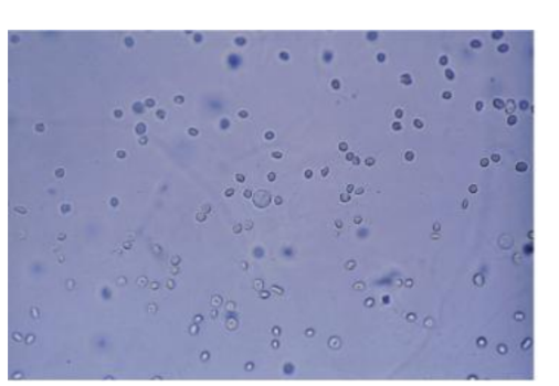 <p>RBC ( red blood cells)</p>