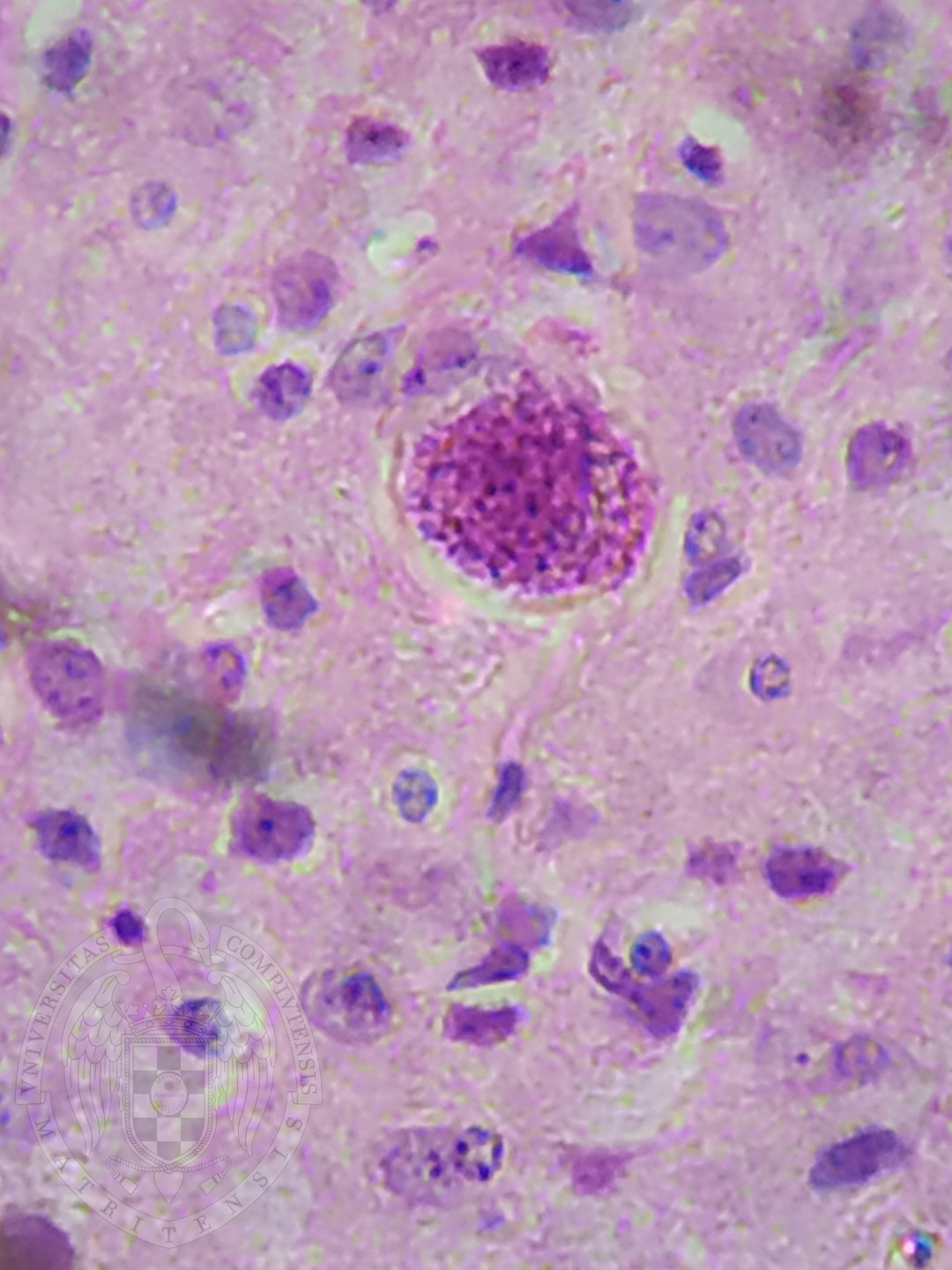<p>in humans or cats</p><p>fever, muscle aches</p><p>worldwide</p>