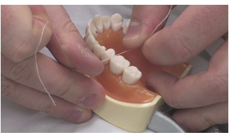 <ul><li><p>the area where the crowns of adjacent teeth in the same arch physically touch on each proximal surface is the <strong>contact area</strong>, or as referred to by clinicians, the contact</p></li><li><p>(the clicking sound you hear when flossing between teeth and resistance felt are due to strong contacts)</p></li></ul><p></p>