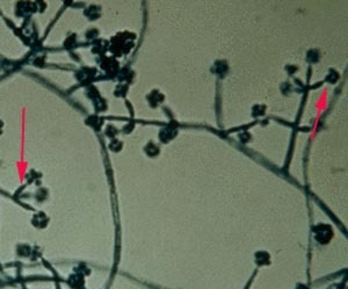 <p>The arrows in the image on the right point to single, long, tapered phialides that extend laterally from either side of the hyphae. This is an identifying feature of which of the fungi listed below?</p><p>A. Trichoderma species</p><p>B. Penicillium species</p><p>C. Beauveria species</p>