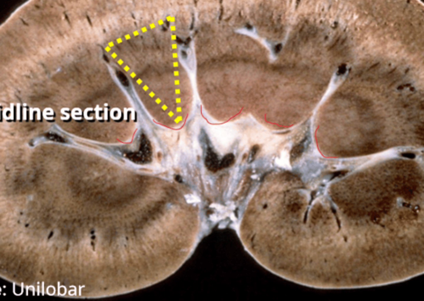 <p>papillae (lined in red)</p>