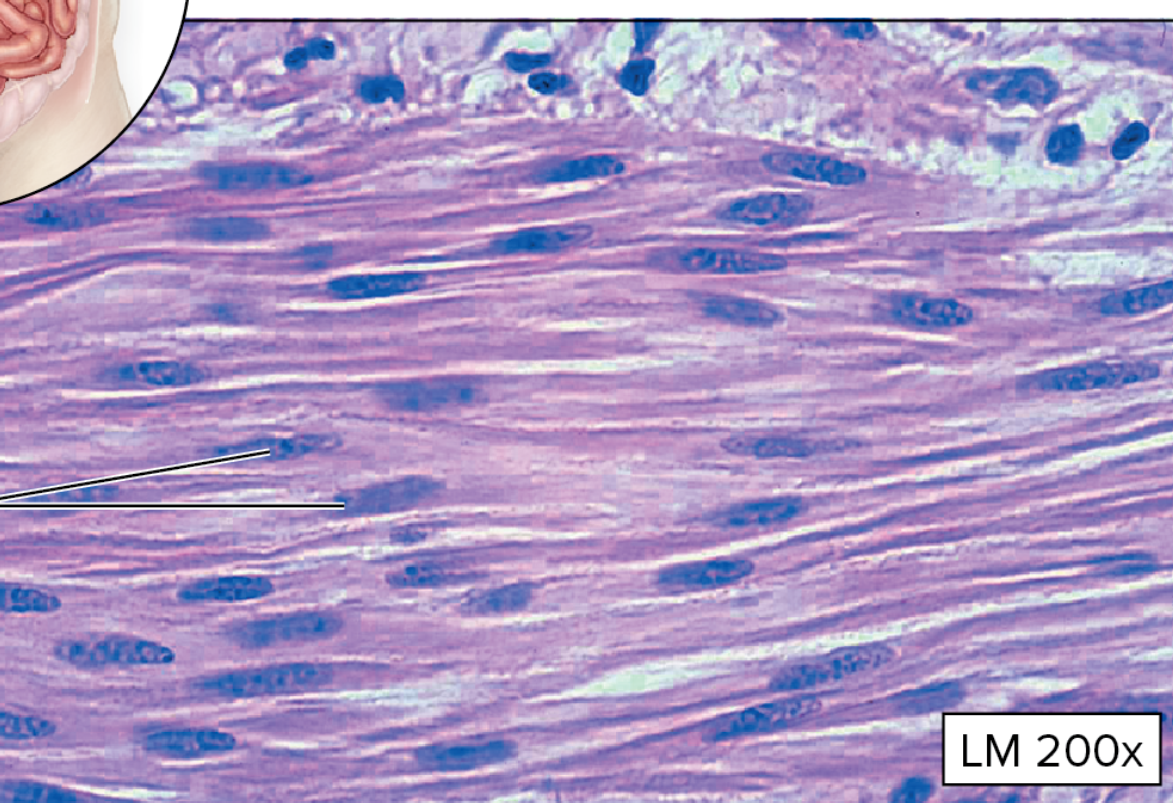 <p>What type of muscular tissue is this?</p>