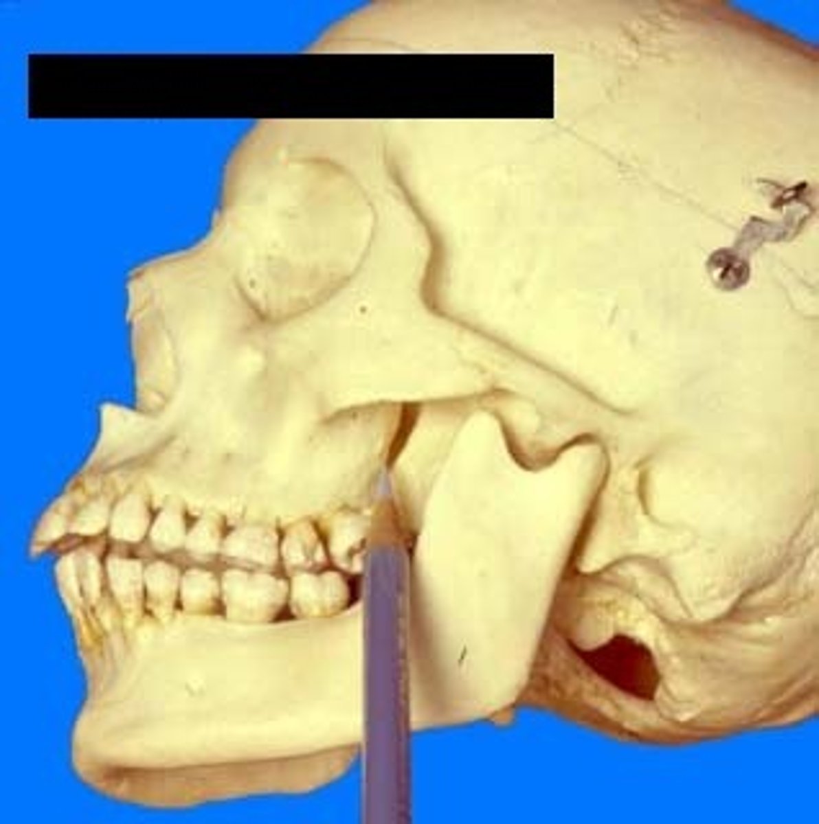 <p>what is this structure and what passes through it </p>