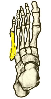 Name the highlighted foot bone