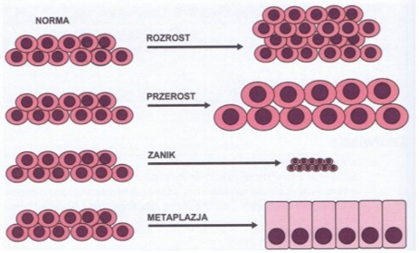 <p>rozrost, przerost, zanik, metaplazja</p>