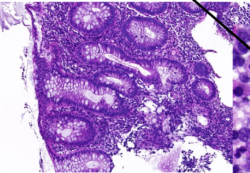 <p>welke pathologie</p>