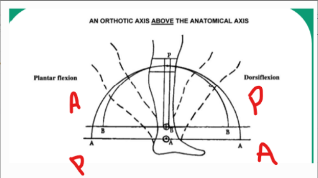 <p>Calf band will move anterior and distal and pressure will be felt on the posterior portion of the leg </p>