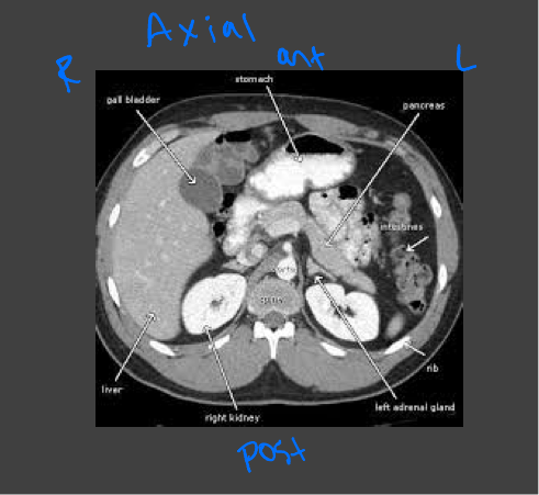 <p>Evaluating the abdominal organs for pathology such as acute abdomen or  trauma</p>