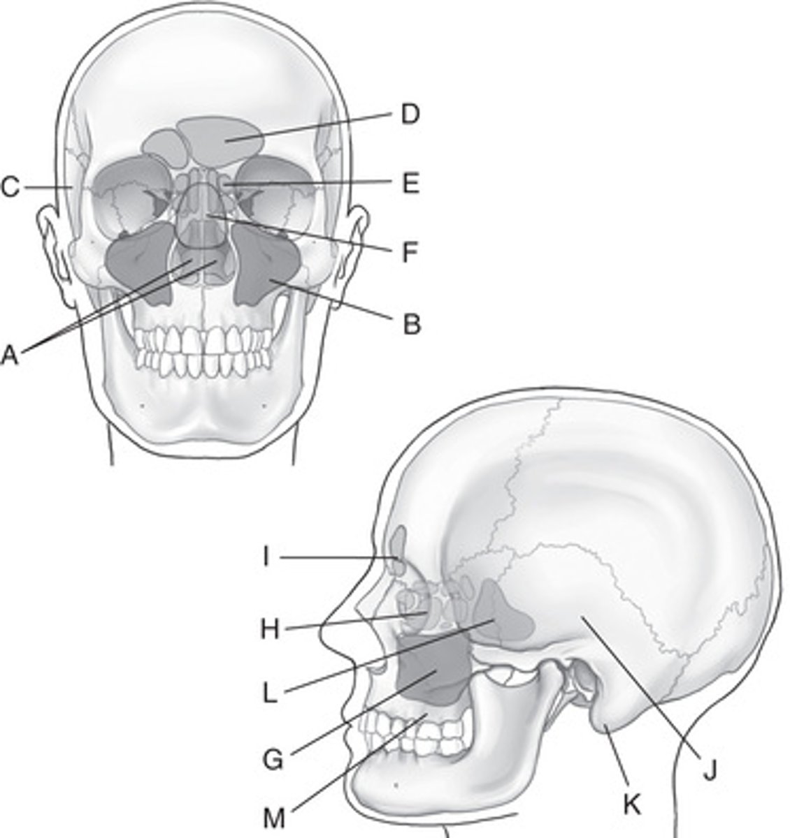 <p>A. Nasal cavity (fossae)</p><p>B. Maxillary sinuses</p><p>C. Right temporal bone (squamous portion)</p><p>D. Frontal sinuses</p><p>E. Ethmoid sinuses</p><p>F. Sphenoid sinuses</p><p>G. Maxillary sinuses</p><p>H. Ethmoid sinuses</p><p>I. Frontal sinuses</p><p>J. Squamous portion of left temporal bone</p><p>K. Mastoid portion of left temporal bone</p><p>L. Sphenoid sinus</p><p>M. Roots of upper teeth (alveolar process)</p>