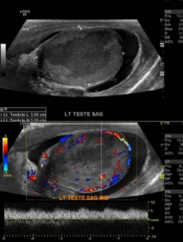 <ol><li><p>What pathology is seen here based on the images?</p></li><li><p>What area is presumably the area of pathology?</p></li></ol><p></p>