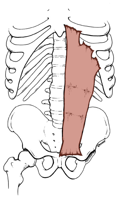 <p>Origin: <span>Pubis and the pubic symphysis</span></p><p>Insertion: <span>Xiphoid process of the Sternum and costal cartilages 5-7</span></p><p>Action: <span>flexes the trunk</span></p>