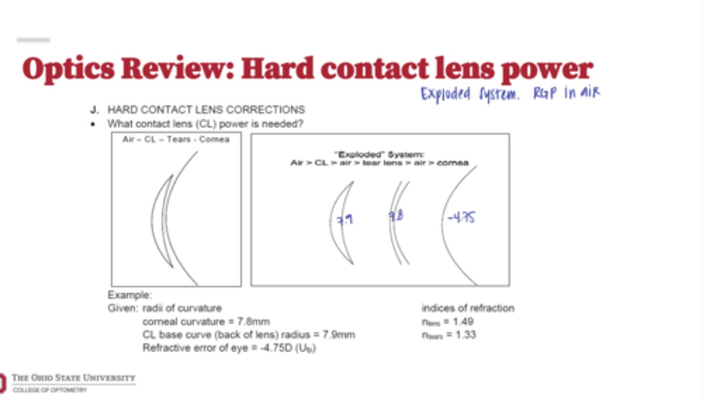 <p>Hard Contact Lens Power in an Exploded System (Pic)</p>