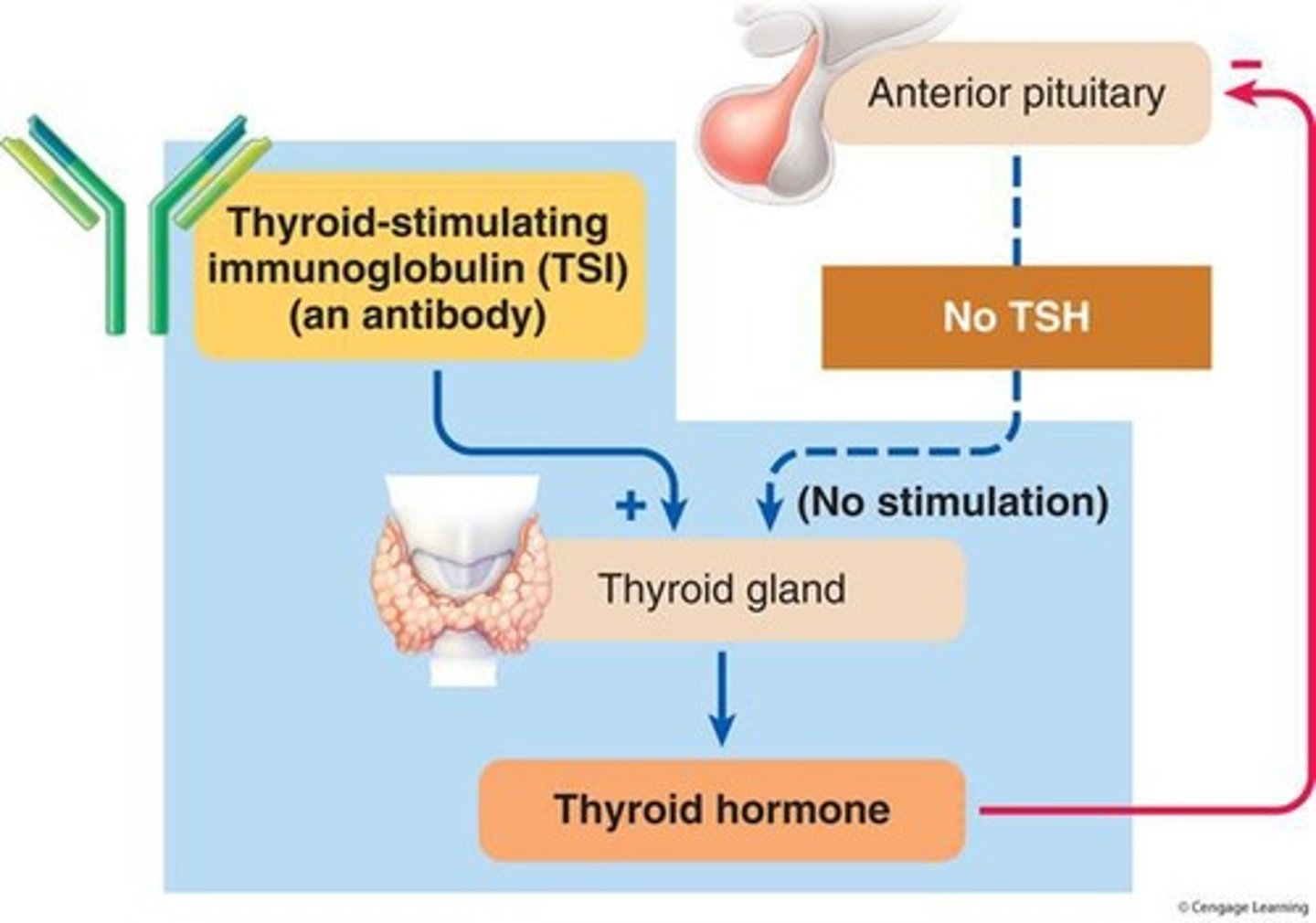 <p>Graves' disease, an autoimmune disorder that produces thyroid-stimulating immunoglobulins.</p>