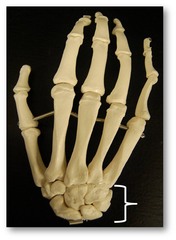 Name this group of bones.