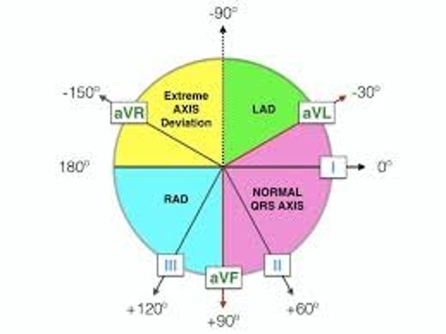 <p>1) Normal</p><p>2) Left axis deviation (LAD)</p><p>3) Right axis deviation</p><p>4) Extreme right axis deviation</p>