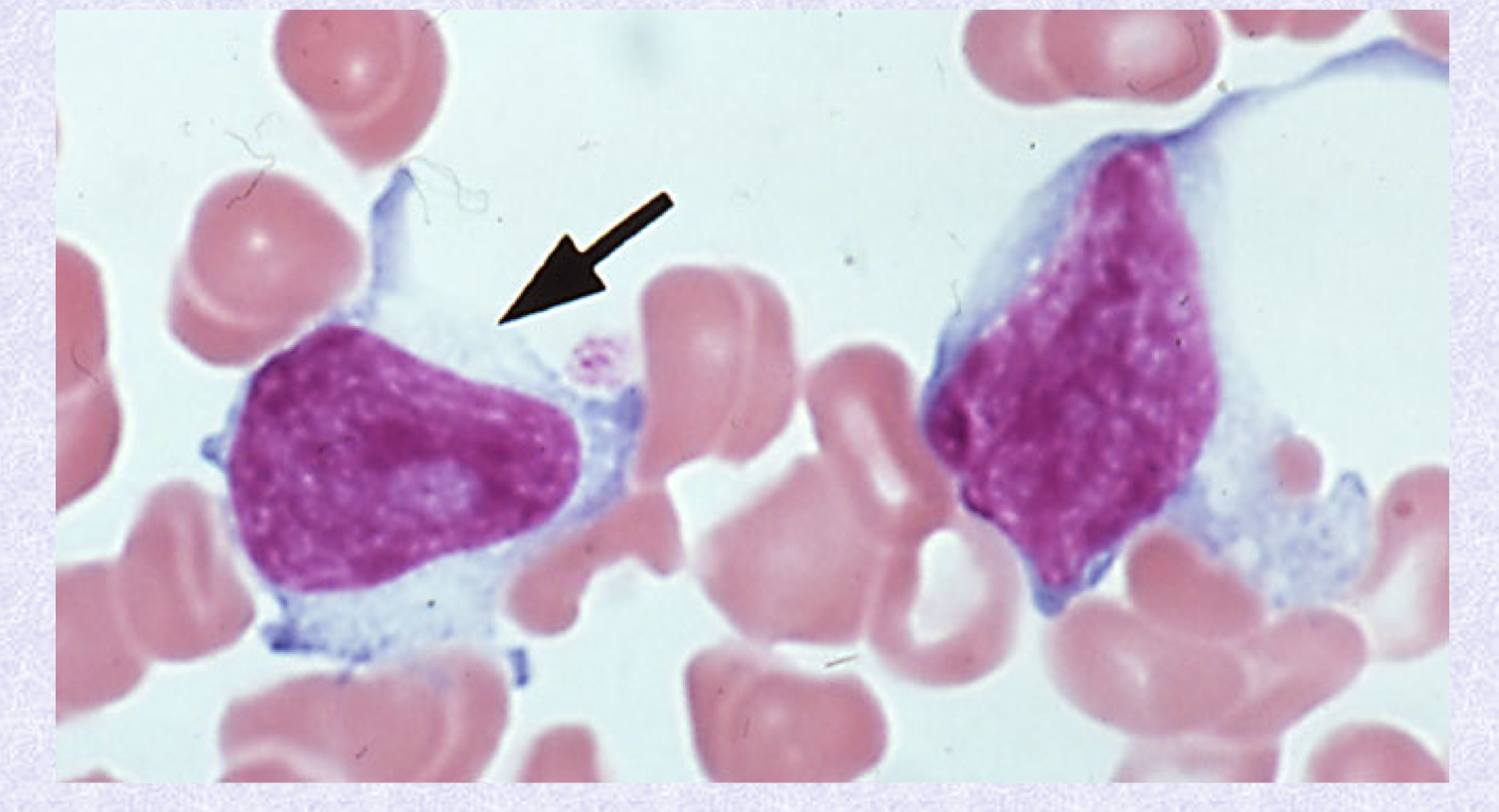 <p>What cell type is shown?</p>