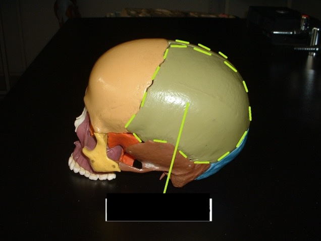 <p>superior posterior; on top and behind the frontal bone but before the occipital bone.</p>