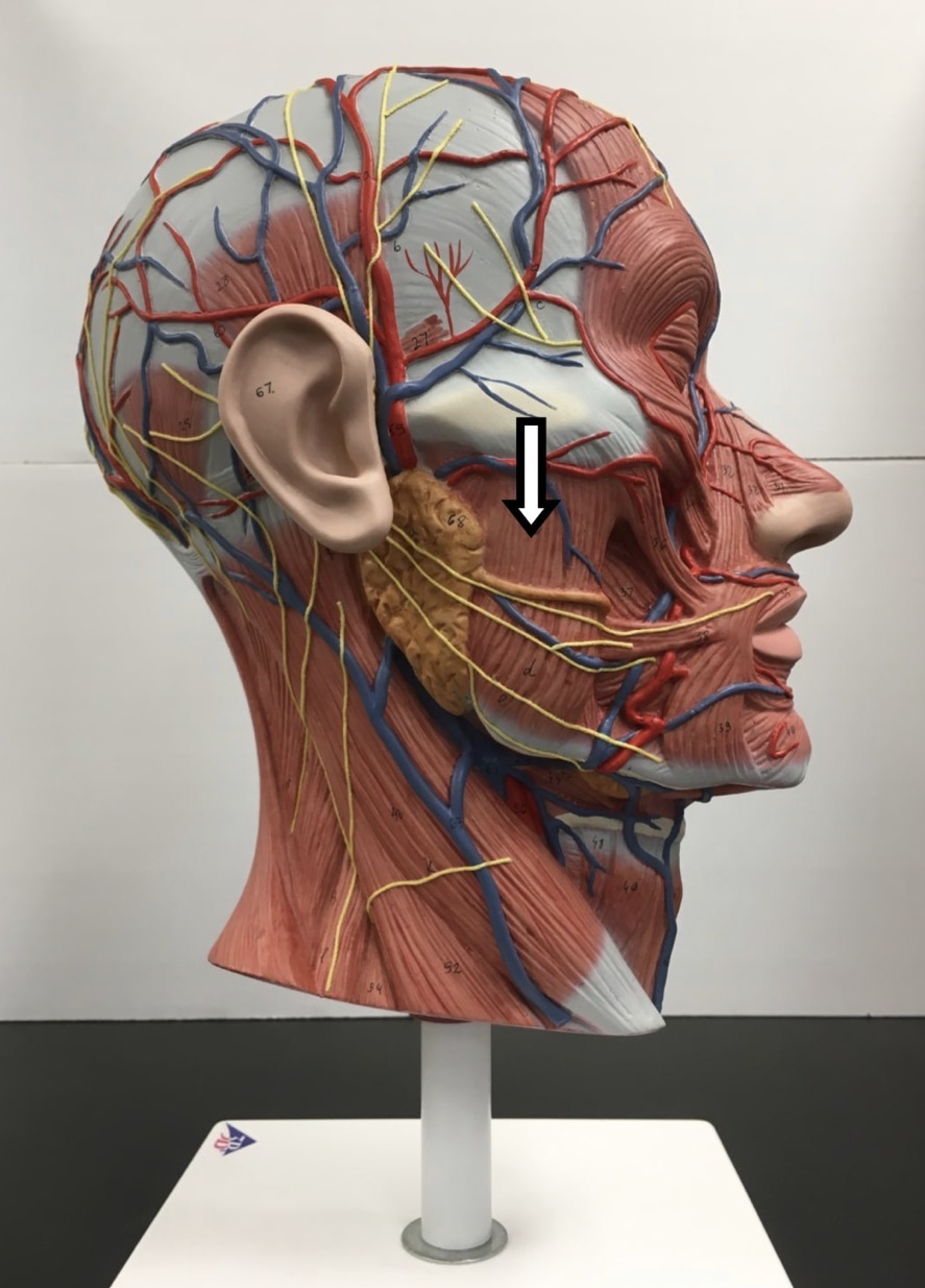 <p><span>Name the muscle labeled with the white arrow below AND name ONE action .</span></p>