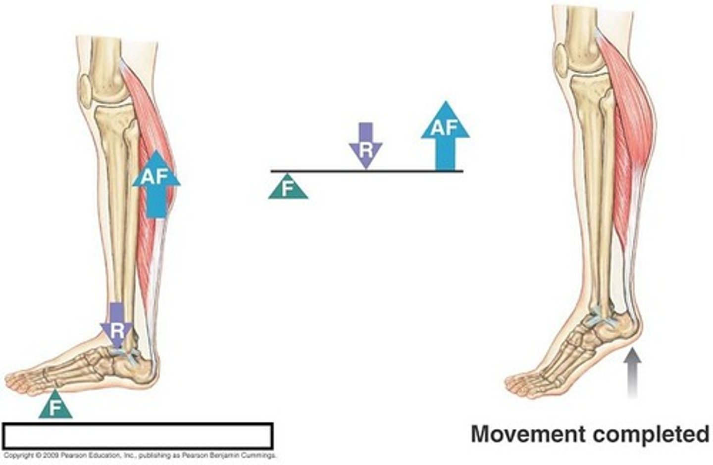 <p>load between fulcrum and effort</p><p>ex-gastrocnemius</p><p>F-ball of foot</p><p>L-weight of body</p><p>E-calf muscle</p>