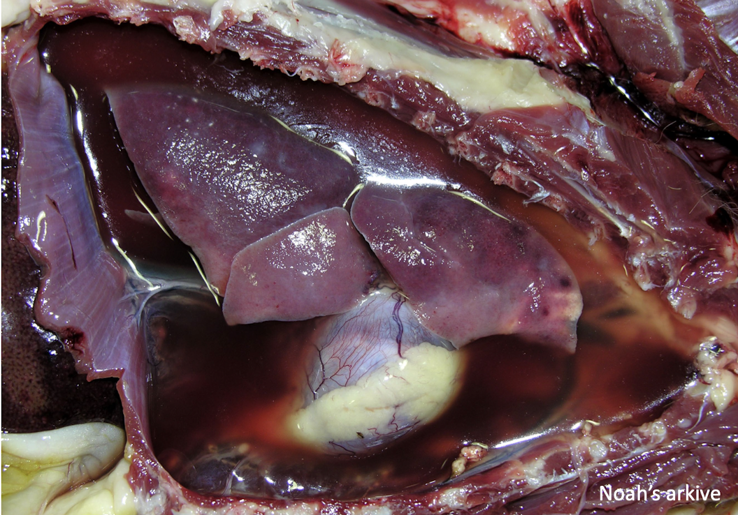 <p>This is typically associated with what clinical syndrome?</p>