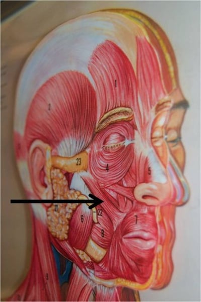<p>Draws angles of the mouth upward and outward; major muscle used in smiling and laughing</p>