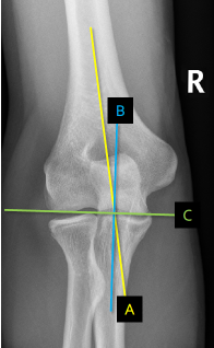 <p>Q what is the name of these lines? </p>