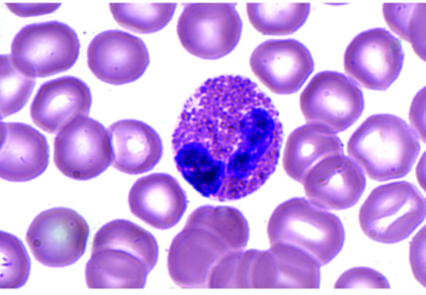 <p>defense (white blood cell)</p>
